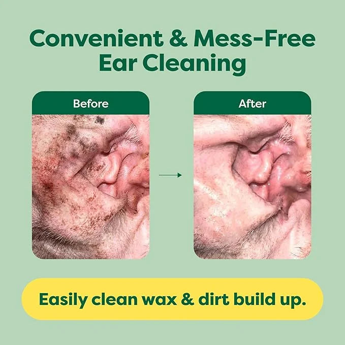 Earth Rated Vet-Developed Pet Ear Wipes, Hypoallergenic Cleaner for Dogs & Cats Ears to Remove Dirt and Wax Build Up, Wild...